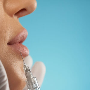 Dermal Fillers
